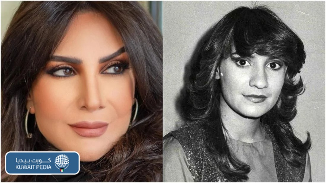 صور-هدى-حسين-قبل-وبعد-عمليات-التجميل.-1