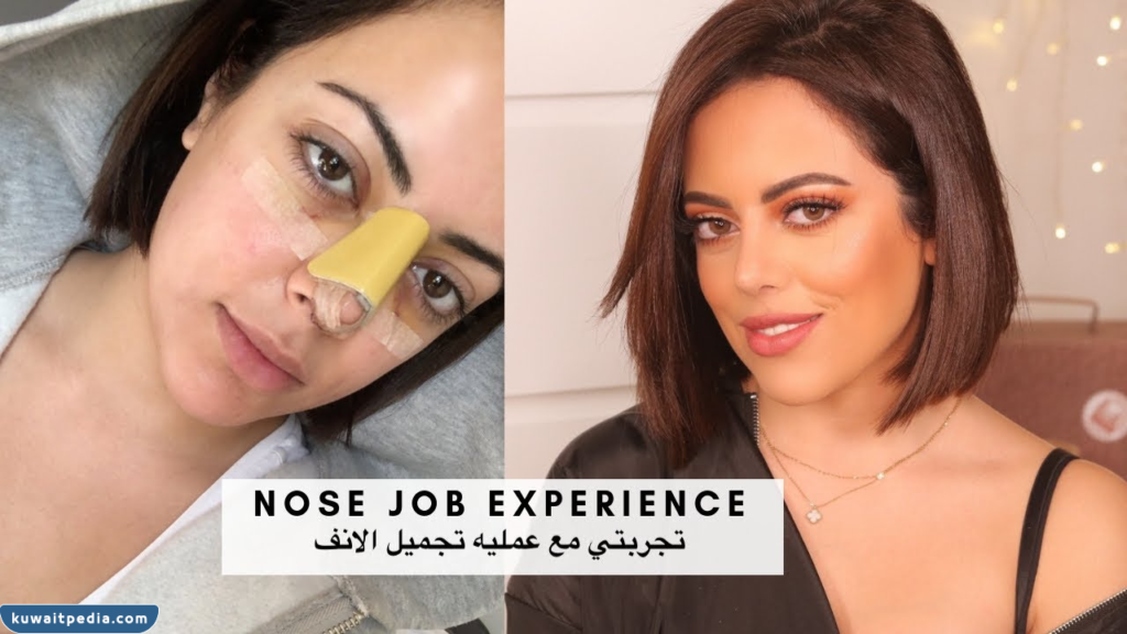 صمود المؤمن قبل التجميل