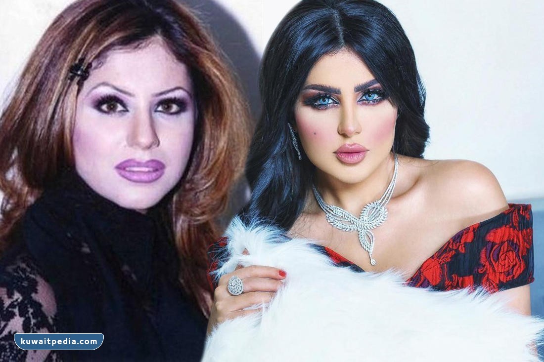 حليمة بولند قبل وبعد عمليات التجميل بالصور-3