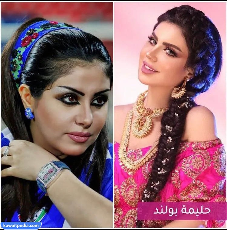 صور حليمة بولند قبل وبعد-2