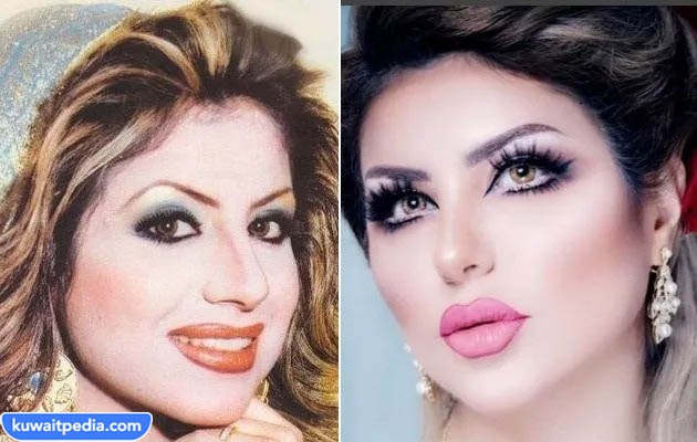 صور حَليمة بولَند قبل وبعد
