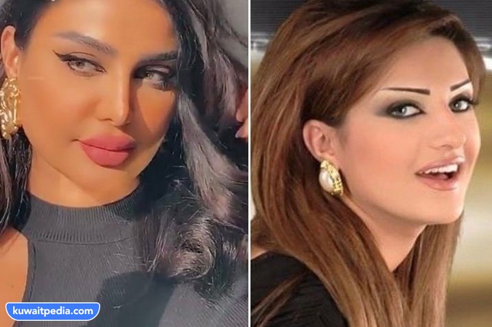 أمل العوضي قبل وبعد