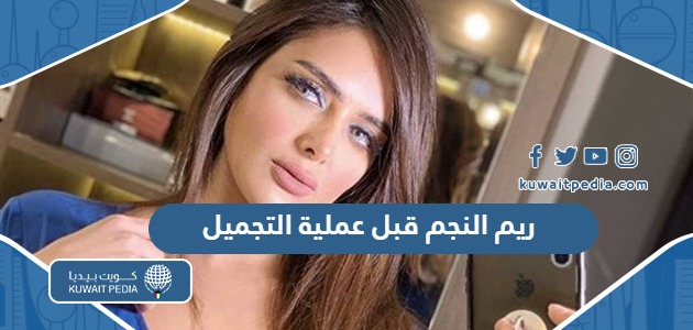 ريم النجم قبل عملية التجميل بالصور